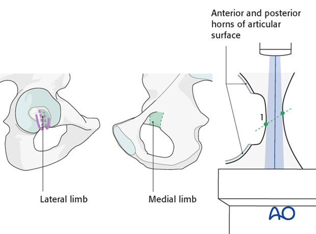 radiology of the intact acetabulum