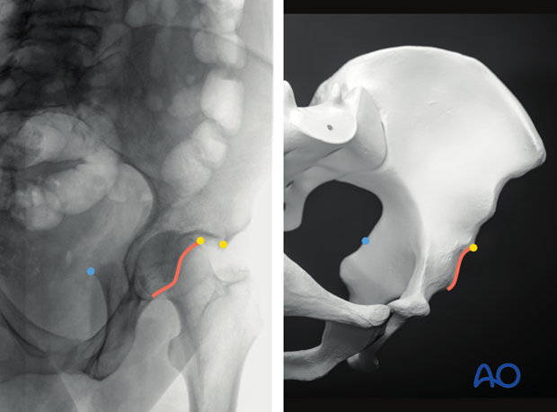 radiology of the intact acetabulum