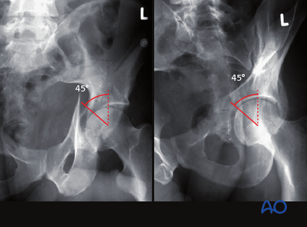 decision making nonoperative vs surgical treatment