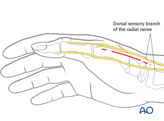 Radiopalmar approach to the base of the thumb