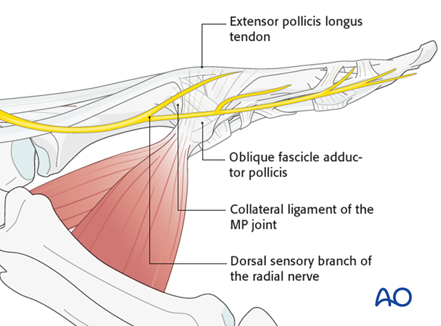 On the ulnar aspect of the metacarpophalangeal (MCP) joint of the thumb are seen the transverse and oblique fibers of the ...