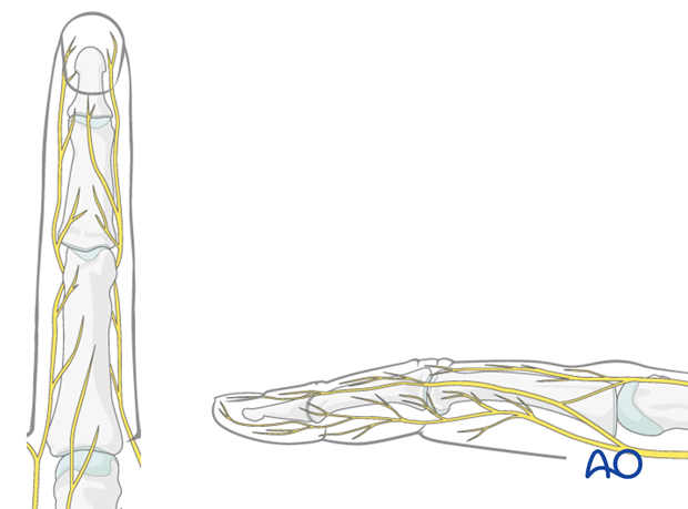 Blunt dissection extends the approach into the thin subcutaneous tissue, taking care to identify and protect the dorsal ...