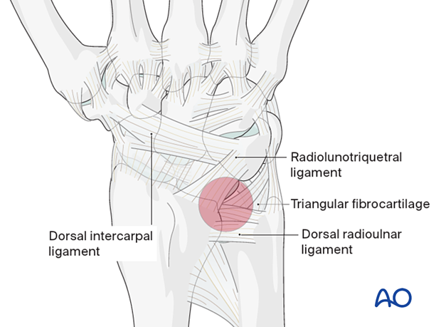 Dorsal ligaments of the carpus with the dorsal radioulnar ligament and the triangular fibrocartilage highlighted