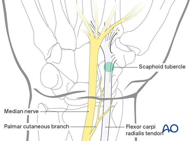 Palmar approach to the scaphoid – Anatomical landmarks