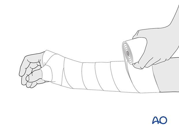 Padding the forearm and wrist for splint application