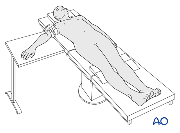 Patient in supine position with the arm on a radiolucent side table