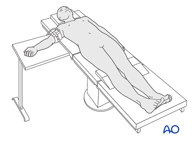 Patient in supine position with the arm on a radiolucent side table