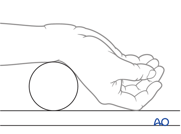 The wrist is positioned over a rolled towel for contol of scaphoid orientation