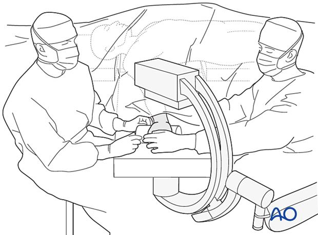 OR setup for hand and wrist surgery using a small C-arm