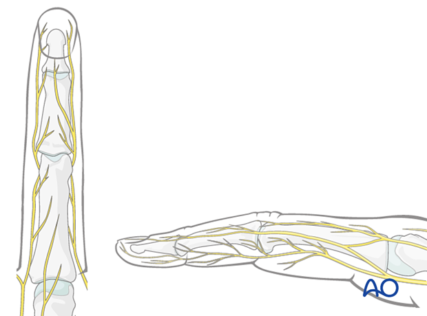 Dorsal sensory branches of radial and ulnar nerves - finger