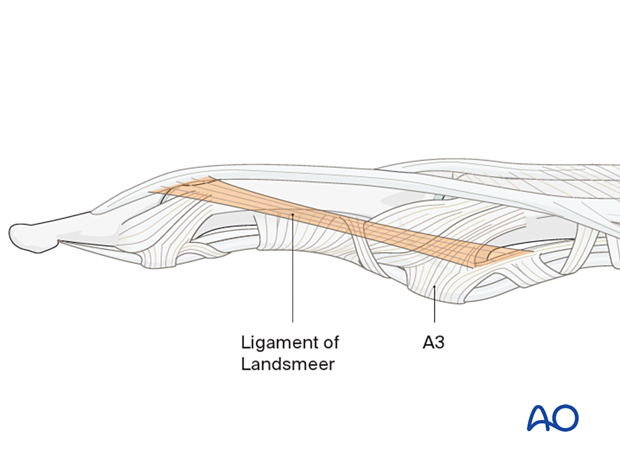 Oblique retinacular ligaments of Landsmeer