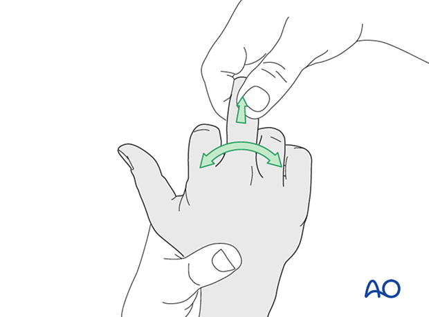 Checking joint stability at the metacarpophalangeal and interphalangeal joint