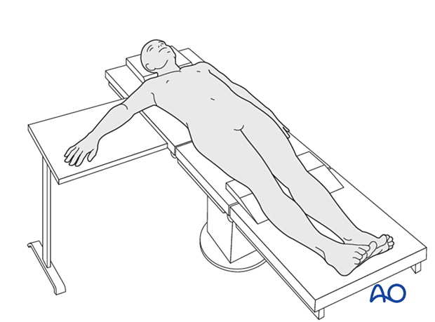 Patient in supine position with the arm on a side table