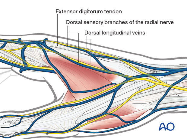 Radial view showing the surgical anatomy at the 2nd metacarpal