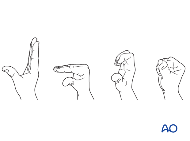 Functional exercises for hand and fingers