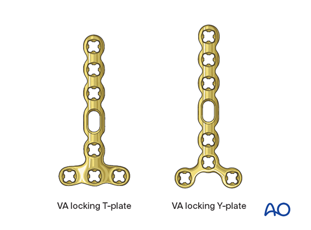 Plate selection for fixation of complete articular fractures of the metacarpal base