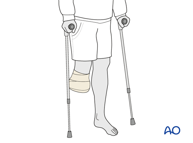 combined hindfoot injuries