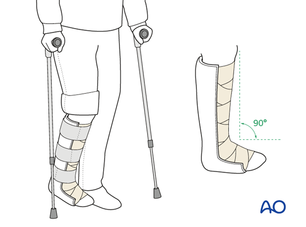 orif plate and screw fixation