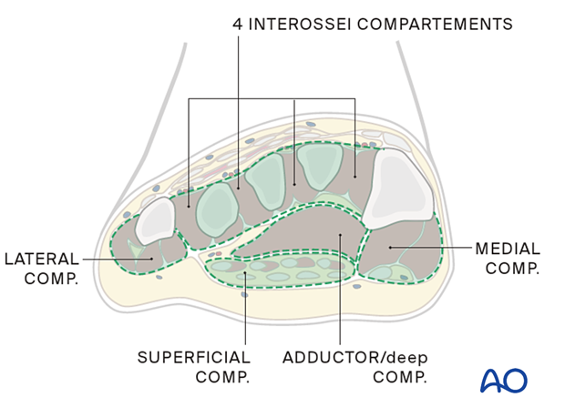 approach to the le fort i level of the midface in cleft lip and palate patients