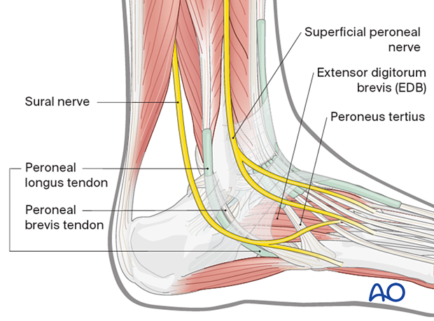 Key anatomical structure in dorsolateral approach to the cuboid