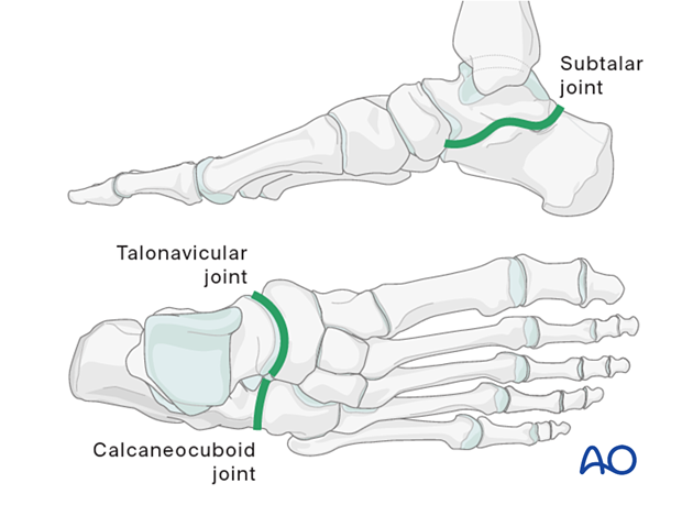 Joints of the hind and midfoot