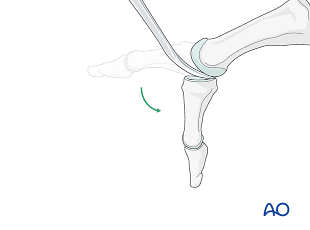 Visualization of the joint