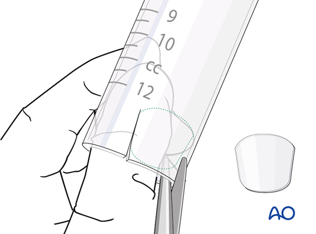 Preparation of orthosis