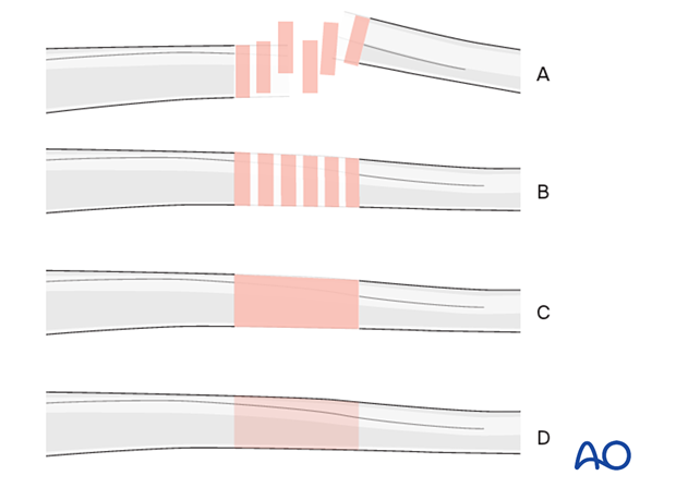 Generic fracture patterns