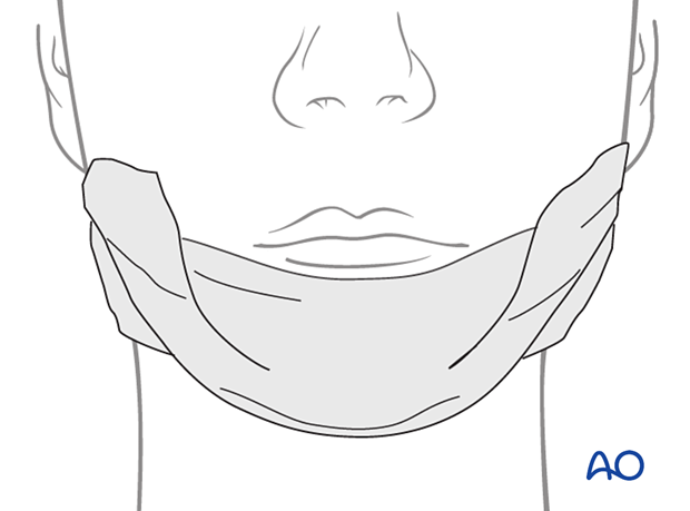 Elastic pressure dressing