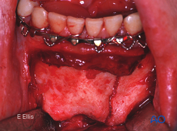 Clinical image of the exposure