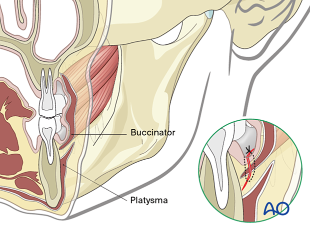 The suture should catch all layers