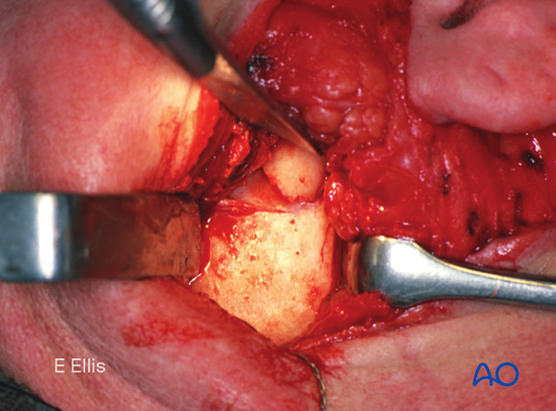 Clinical picture of exposure