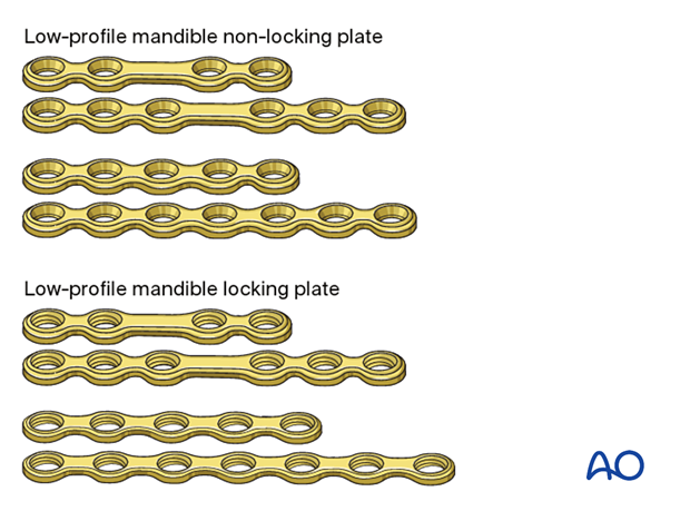 Choice of implant for superior plate