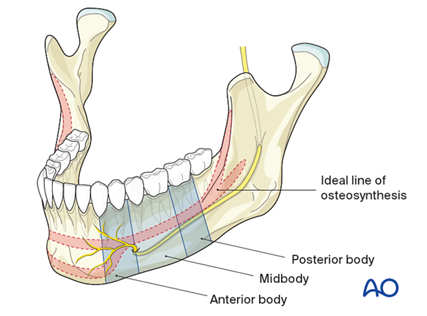 ideal line of osteosynthesis in the body region 