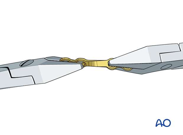 Twist the plate approximately 90° to facilitate adaptation to the superior mandibular border in the angle region