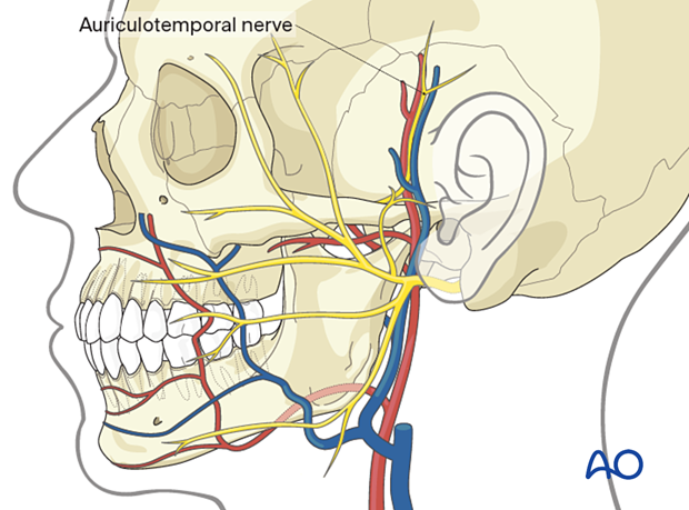 approach to the le fort i level of the midface in cleft lip and palate patients