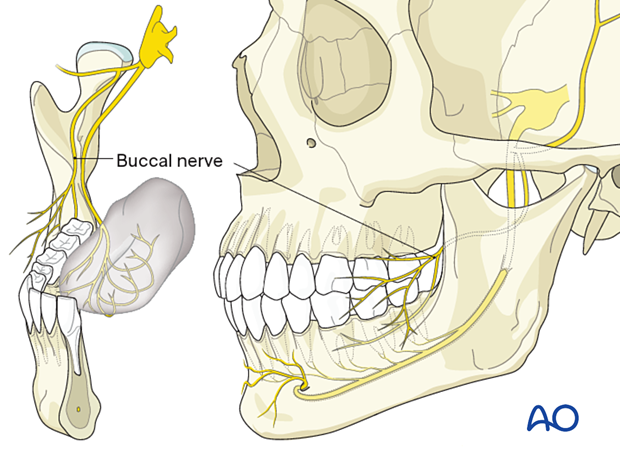 approach to the le fort i level of the midface in cleft lip and palate patients