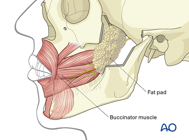 approach to the le fort i level of the midface in cleft lip and palate patients