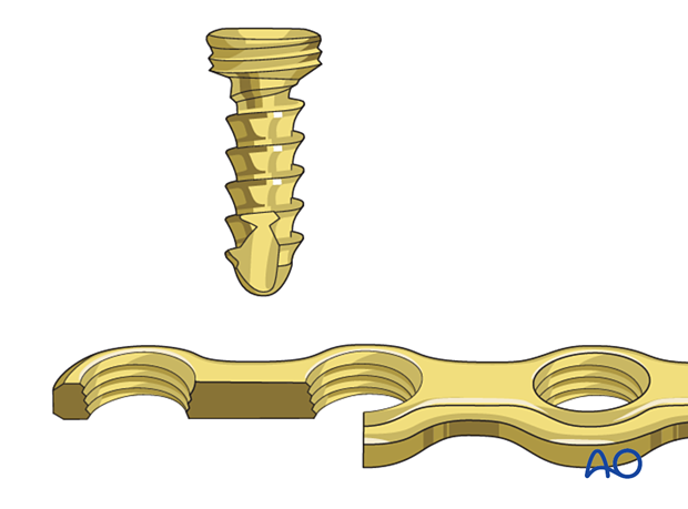 Locking head screws