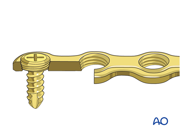 Locking head screw inserted in locking head