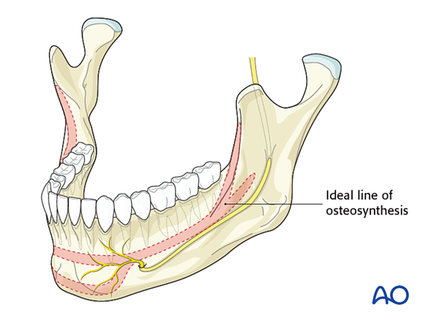 91 X072 Biomechanics of the mandible