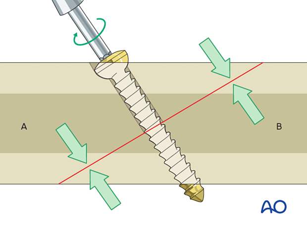 Lag screw technique