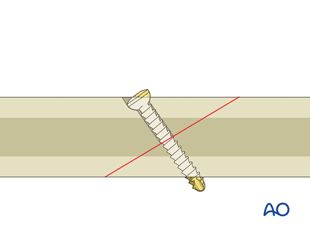 Self tapping screw