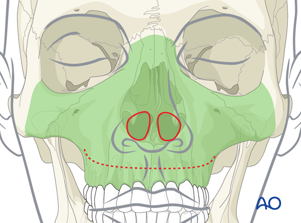 Approaches to the maxilla