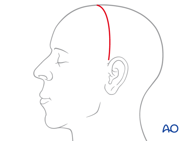 Inferior extent of incision line