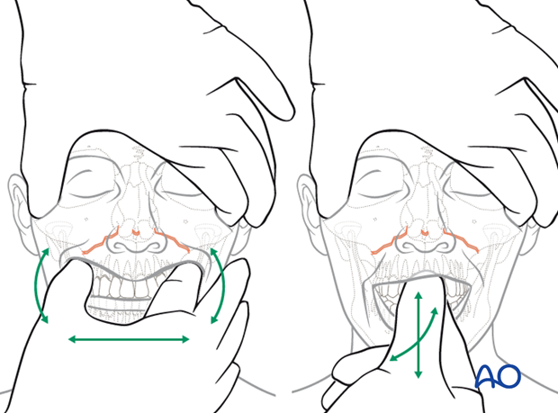 examination of patients with midfacial injuries