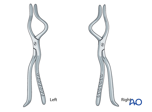 open reduction internal fixation