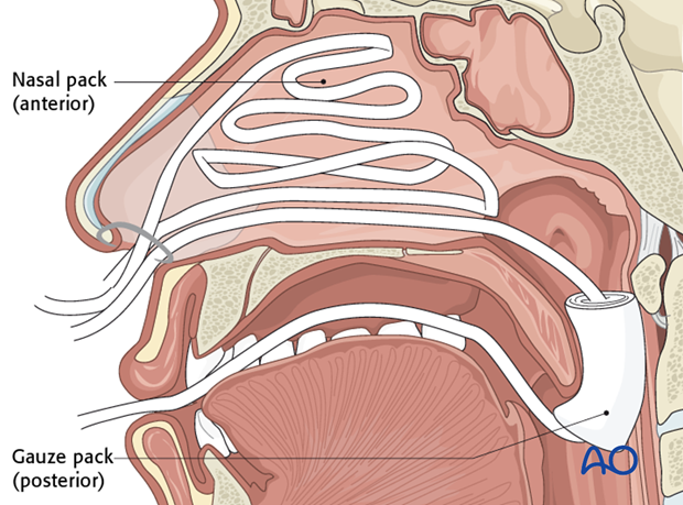 Airway considerations