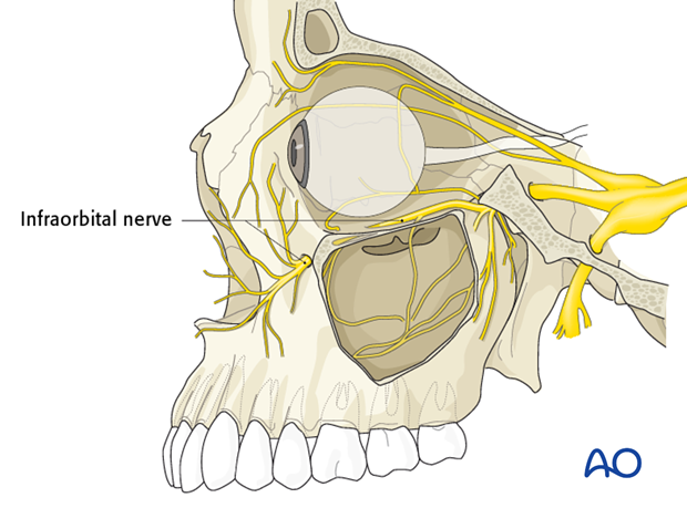 orbital reconstruction