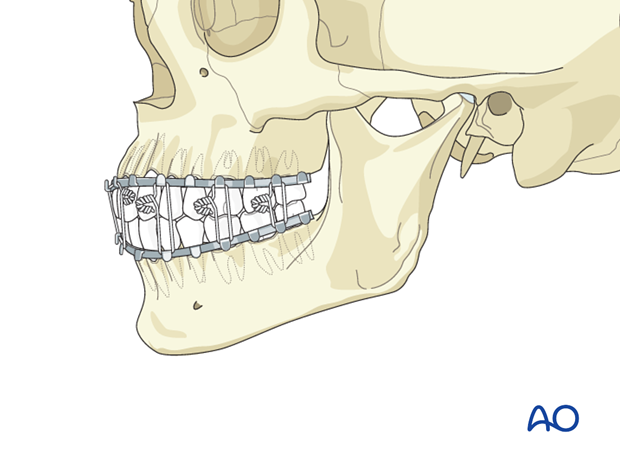 Airway considerations